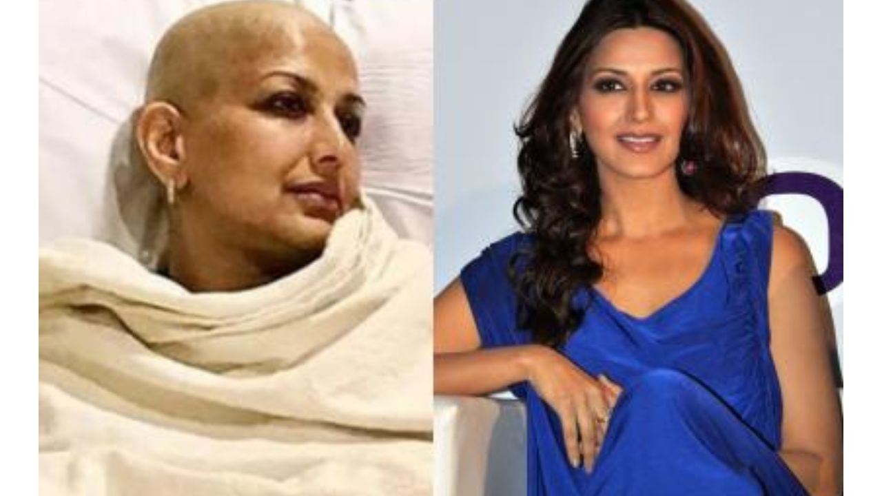 ক্যানসার চিকিৎসার পর সূর্যের আলোতে ত্বক সংবেদনশীল হয়েছে: সোনালি বেন্দ্রে